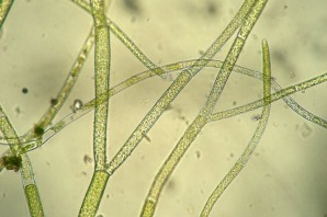 Спирогира под микроскопом