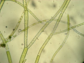 Спирогира под микроскопом