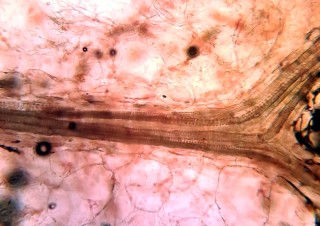 Клетки томата под микроскопом