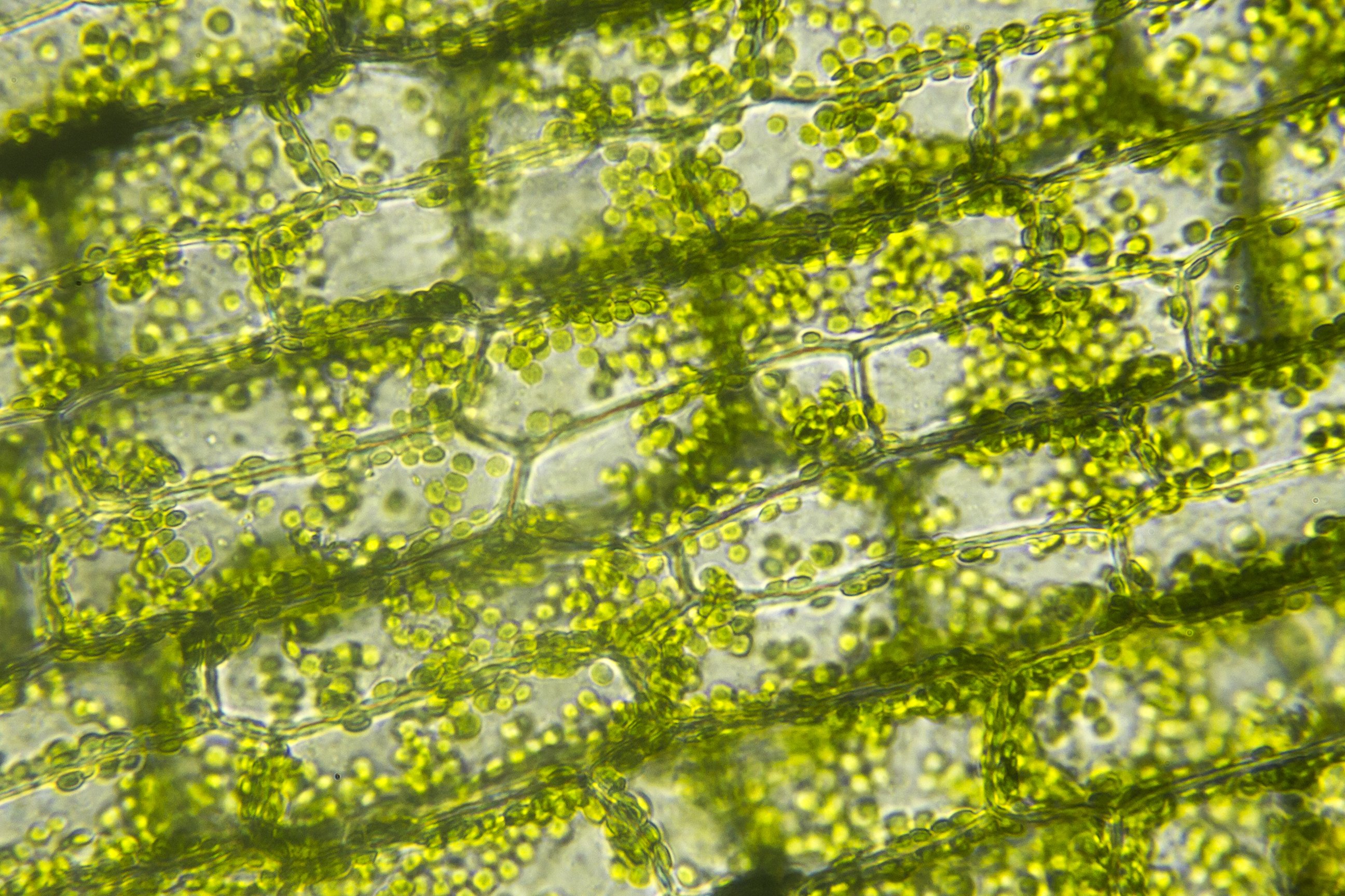 Клетка бурой водоросли. Клетки водоросли элодеи. Элодея канадская. Лист элодеи под микроскопом. Элодея хлорофилл.
