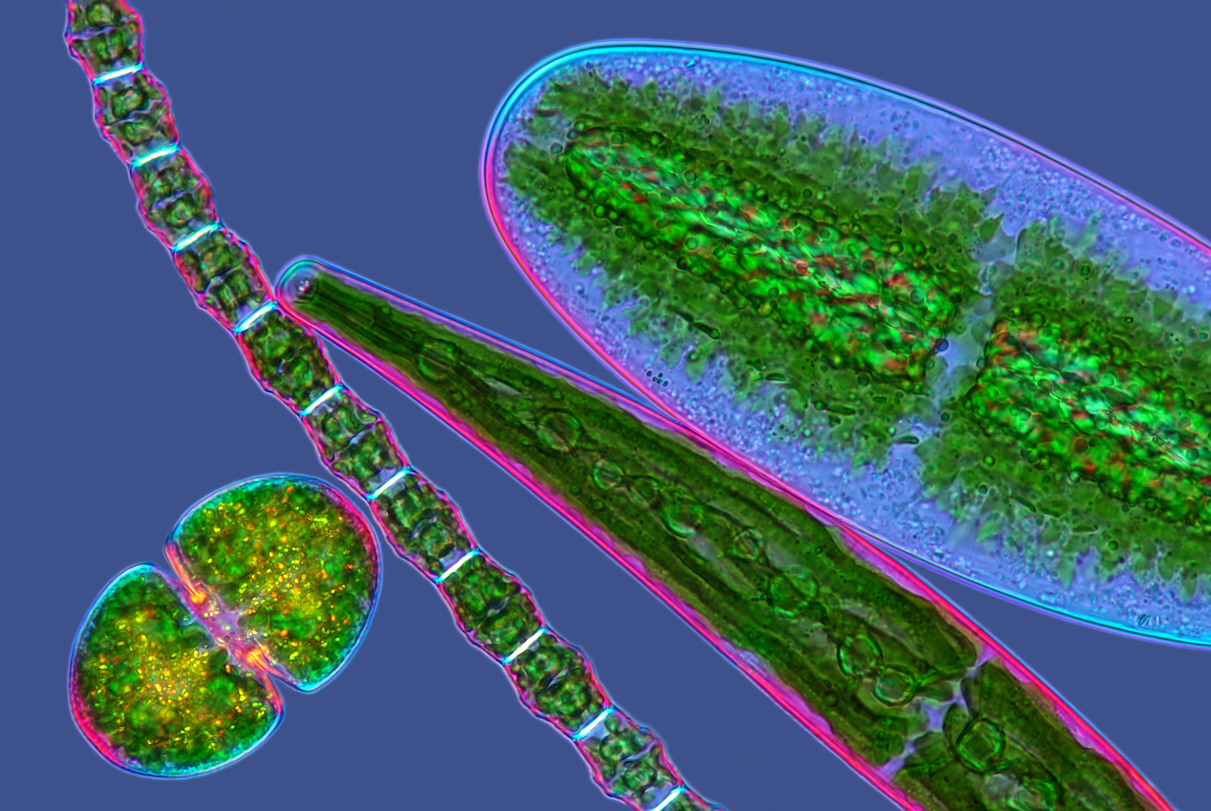 Спирогира одноклеточная. Диатомовые одноклеточные водоросли. Диатомовые водоросли микроскоп. Спирогира под микроскопом. Динофлагелляты водоросли.