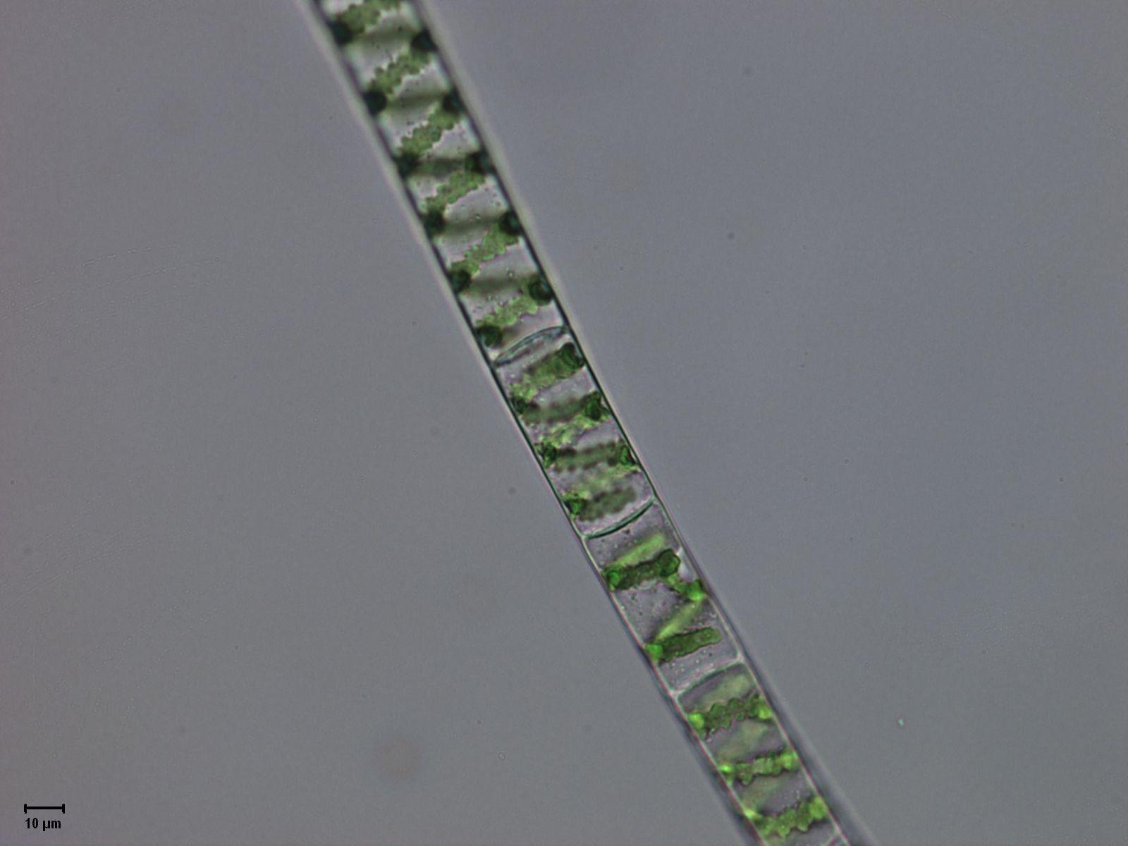 6 спирогира. Спирогира водоросль. Нитчатая водоросль спирогира. Спирогира полусвязанная. Спирогира микроскоп 10x.