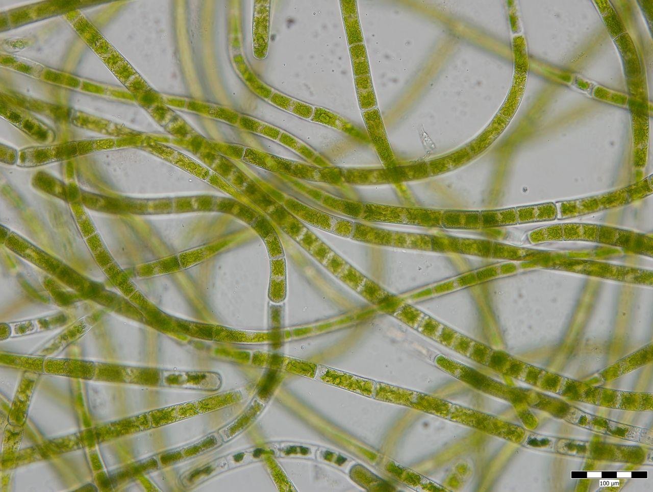 Разрежьте водоросли геншин. Зигнема водоросль. Спирогира водоросль. Водоросль спирогира под микроскопом. Зеленые водоросли спирогира.